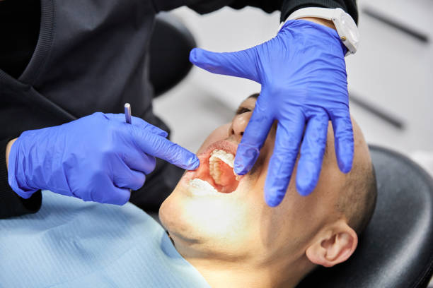 Best Teeth Whitening  in Enon, OH