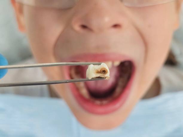Dentist for Dental Trauma in OH